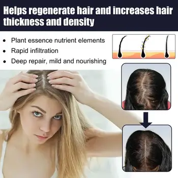 Rast vlasov Séra Polygonum Multiflorum opätovný rast Vlasov Olej vypadávanie Vlasov Prevencia Ošetrenie Pre Mužov, Ženy 30ml